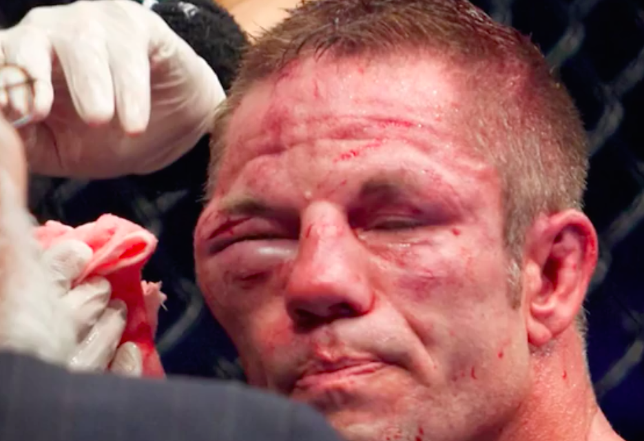 UFC borci pre i posle borbi! (VIDEO)